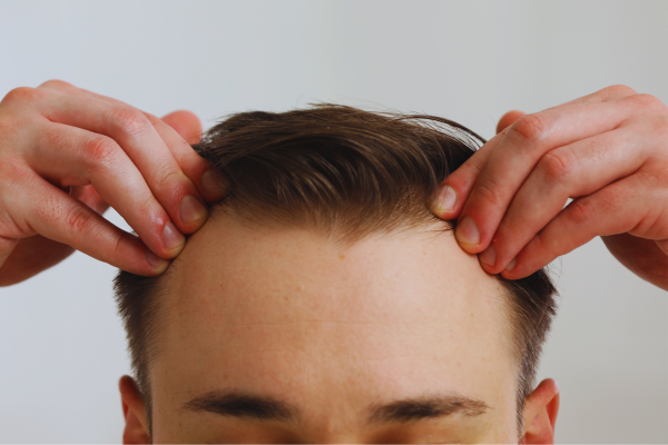 Receding hairline solutions